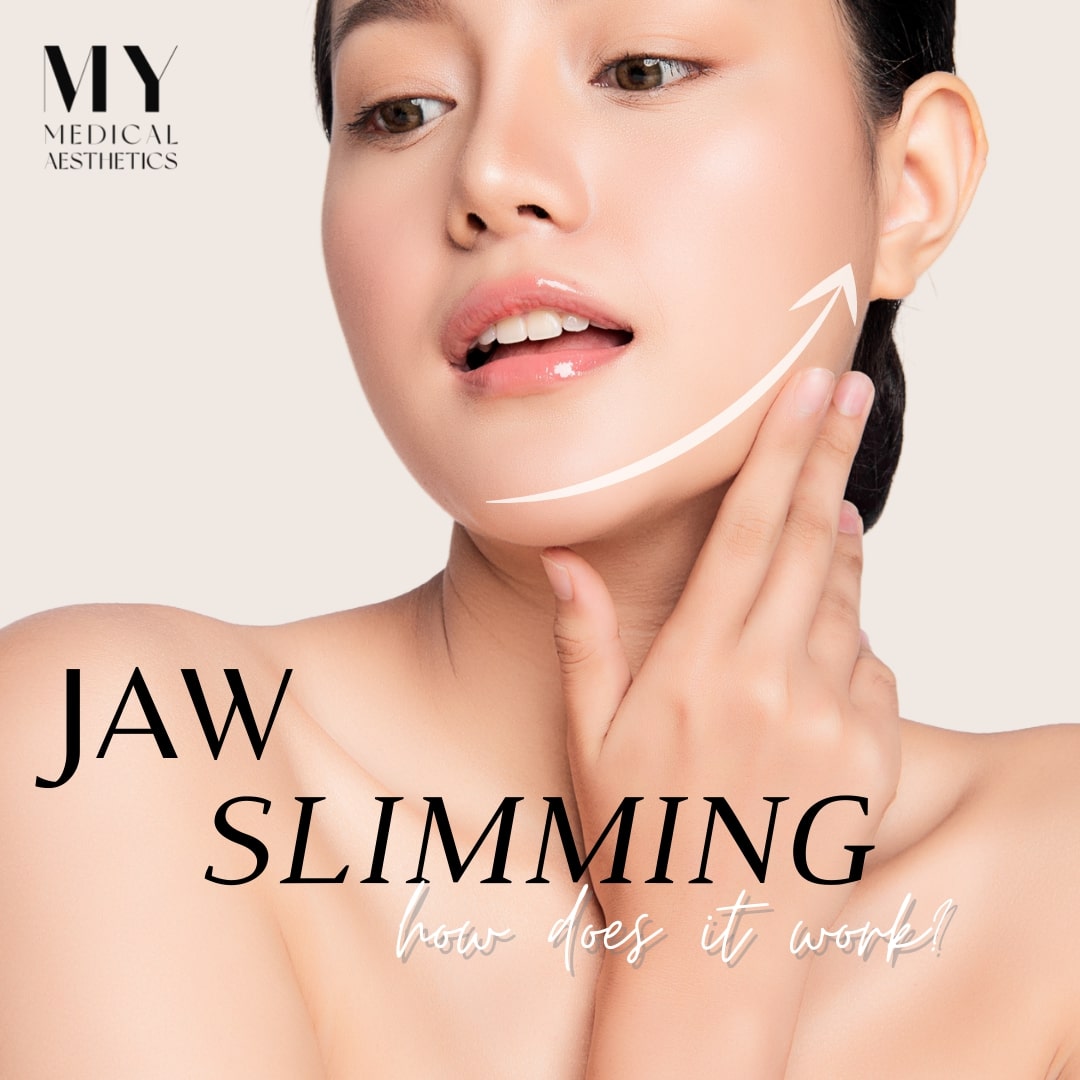 My Medical Aesthetic Jaw Slimming